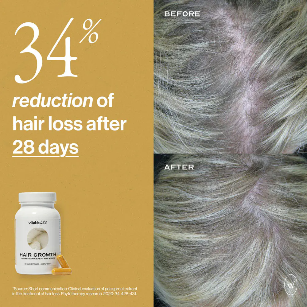 VitableLabs Hair Growth - 60 Capsules, view 11